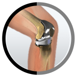 Orthopaedic Surgeon/Doctor in Sharjah and Dubai, knee joint replacement in Sharjah and Dubai